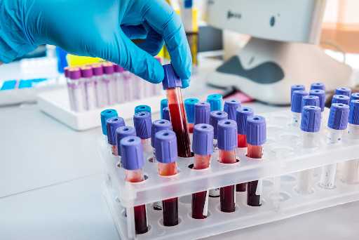 Clinical Testing Services in India